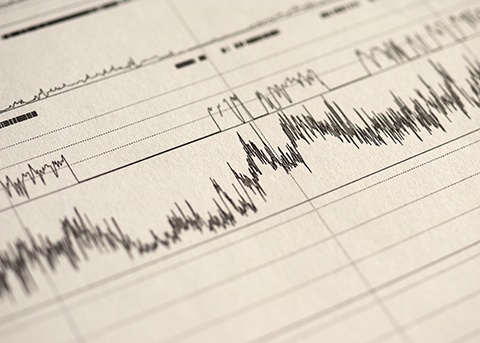 Polysomnography record of sleep test