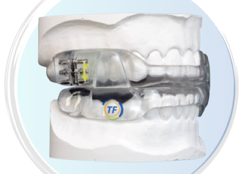 Clear oral appliance covering the teeth in a model of the mouth